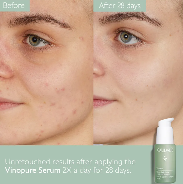 Vinopure Blemish Control Salicylic Serum