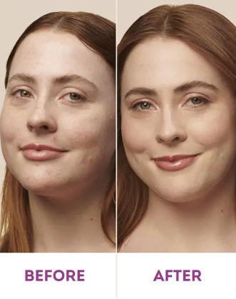 Nude By Nature Natural Mineral Cover Blemish Control Light 10g