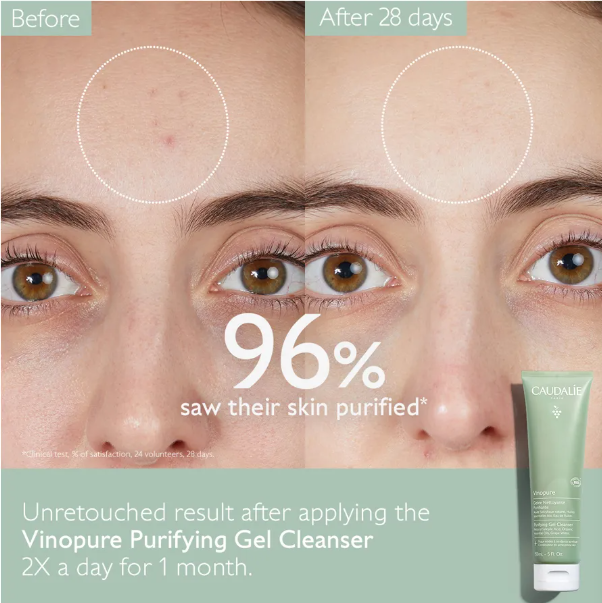 Vinopure Purifying Gel Cleanser • 150ml