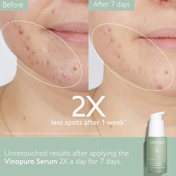 Vinopure Blemish Control Salicylic Serum