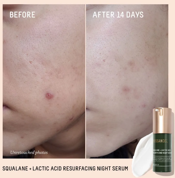 Squalane + 10% Lactic Acid Resurfacing Serum