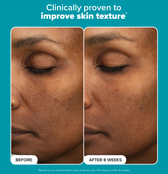 Skin Perfecting 6% Mandelic + 2% Lactic Acid Liquid Exfoliant 88ML