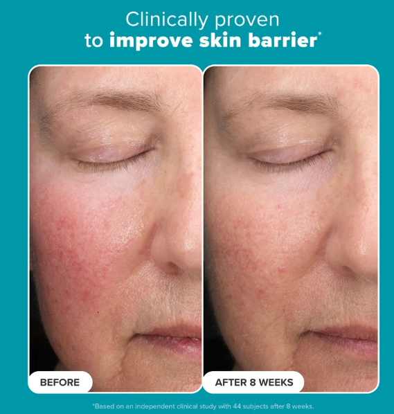 Skin Perfecting 6% Mandelic + 2% Lactic Acid Liquid Exfoliant 88ML