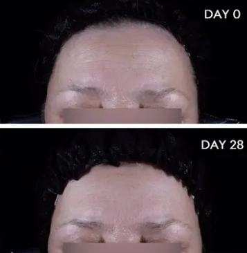 Bioderma Hydrabio Hyalu + Hydrating Plumping Serum with Hyaluronic Acid and Niacinamide 30ml