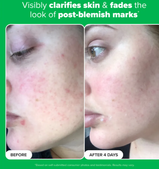 10% Azelaic Acid Booster 30ML