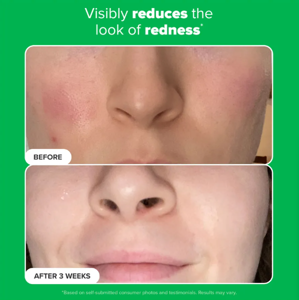 10% Azelaic Acid Booster 30ML