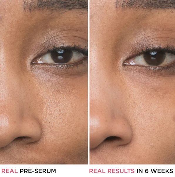 Bye Bye Pores Glycolic Acid Serum 30ML