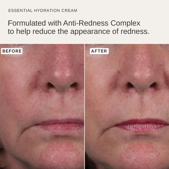 Alpha-H Essential Hydration Cream with Rose Geranium 50ml