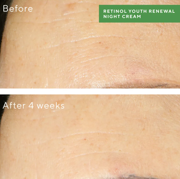 Murad Retinol Youth Renewal Night Cream 50ml