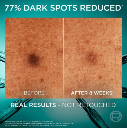 L'Oreal Paris Revitalift Bright Reveal Serum 30ml