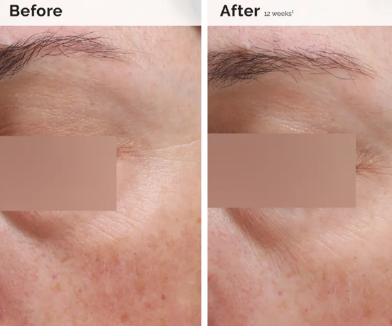 The Ordinary Niacinamide 5% Face And Body Emulsion