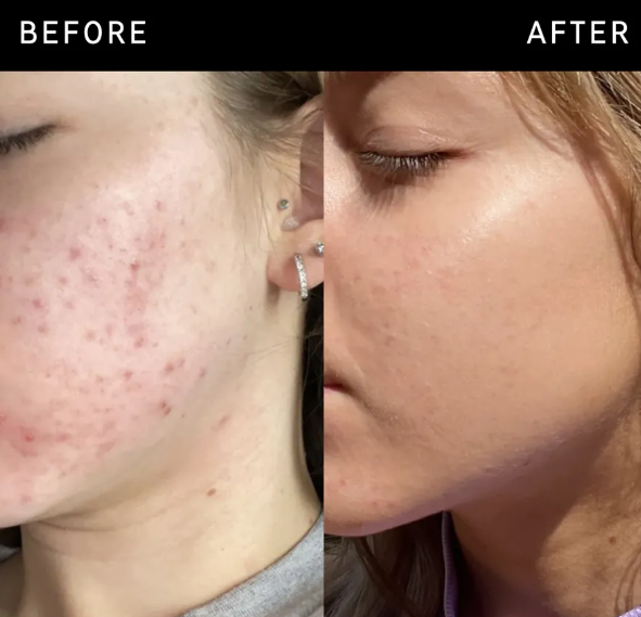 The INKEY List Niacinamide Face Serum 30ml