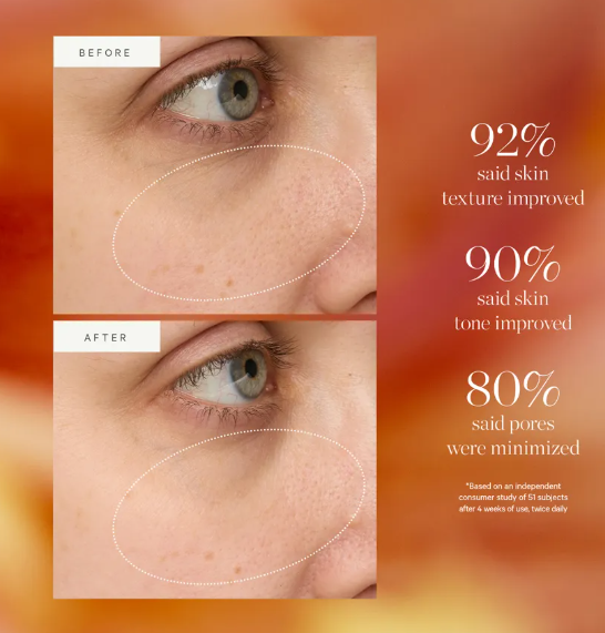 Kora Organics By Miranda Kerr Turmeric Glow Drops Niacinamide Alternative Serum 30ml