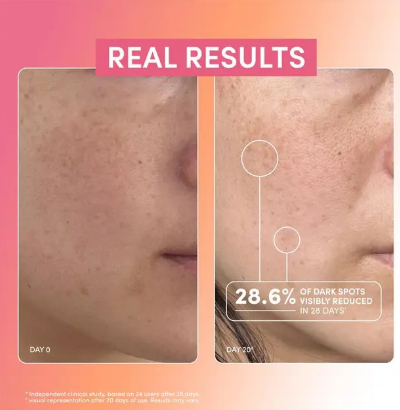 Essano Super Glow Vitamin C 15% Serum 30ml