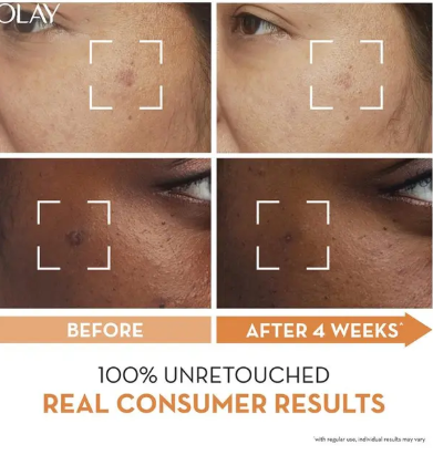 Olay Luminous Vitamin C Super Serum 30ml