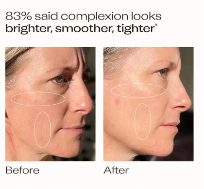 Trilogy Vitamin C+ Super Serum 30ml