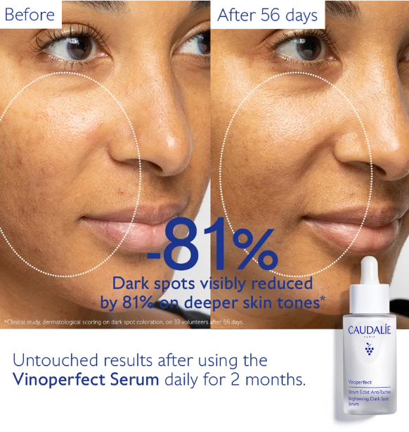 Caudalie Vinoperfect Brightening Dark Spot Serum 50ml