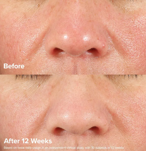 Paula's Choice C15 Super Booster 15% Vitamin C 20ml