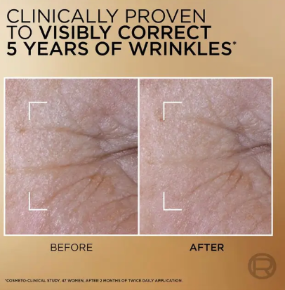 L'Oreal Age Perfect Le Duo Serum 30ml