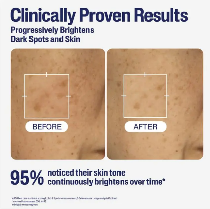 Cetaphil Bright Healthy Radiance Perfecting Serum 30ml