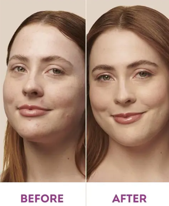 Nude By Nature Natural Mineral Cover Blemish Control Medium 10g