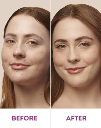 Nude By Nature Natural Mineral Cover Blemish Control Light/Medium 10g